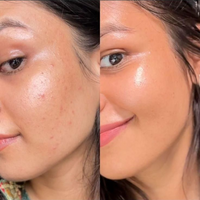 Care for Your Beauty